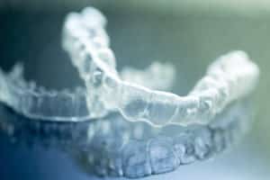 Invisalign In Evergreen – The Clear Winner Over Braces