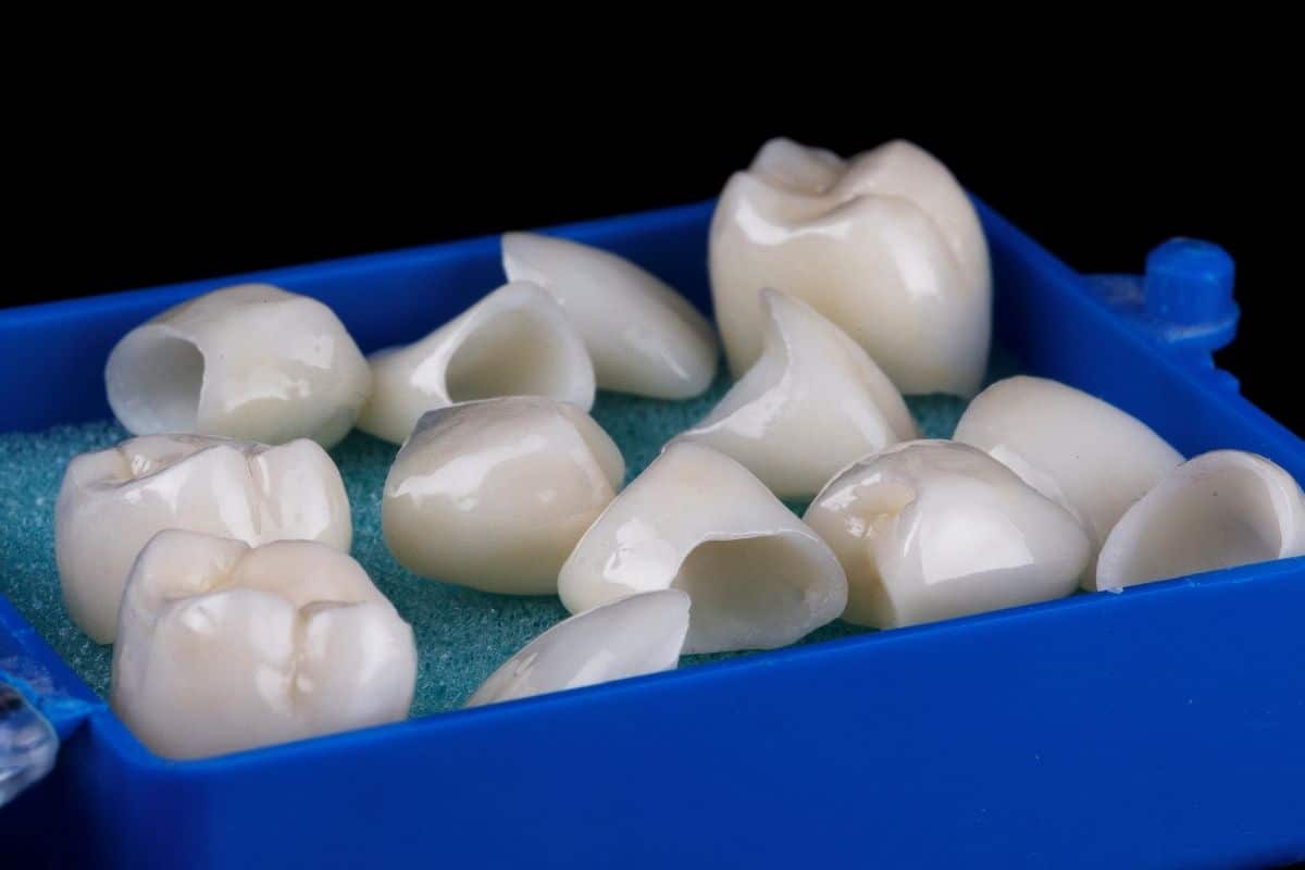 Is It A Good Idea To Get Dental Crowns?