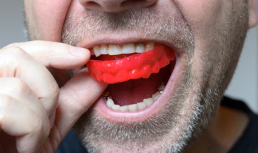 A Complete Guide To Athletic Mouthguards/ Sports guards for children