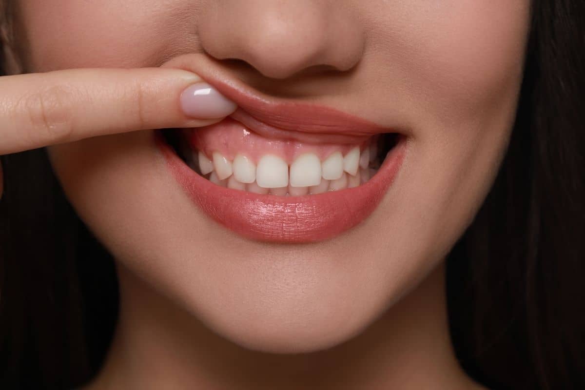 A Complete Guide To Gum Disease Treatment