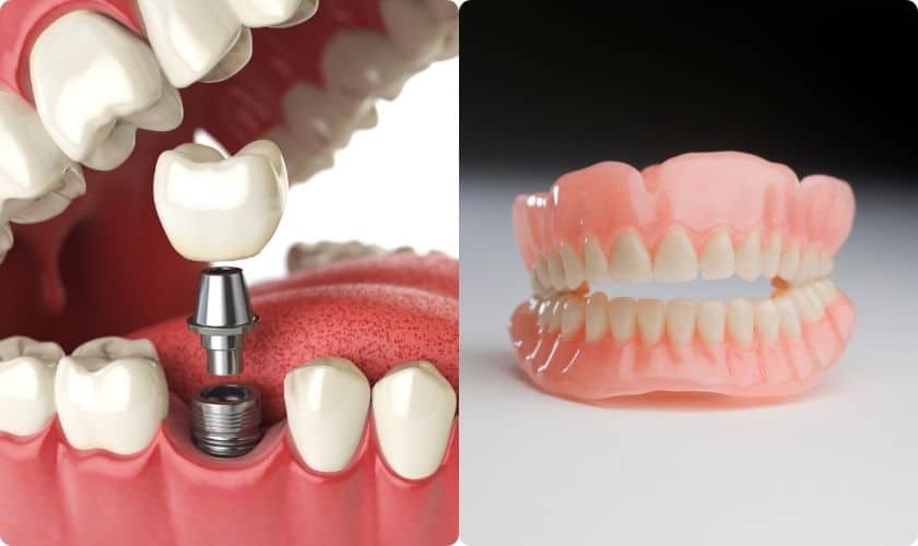 Evergreen Dental Group: Dental Implants vs. Dentures: Choosing the Right Solution
