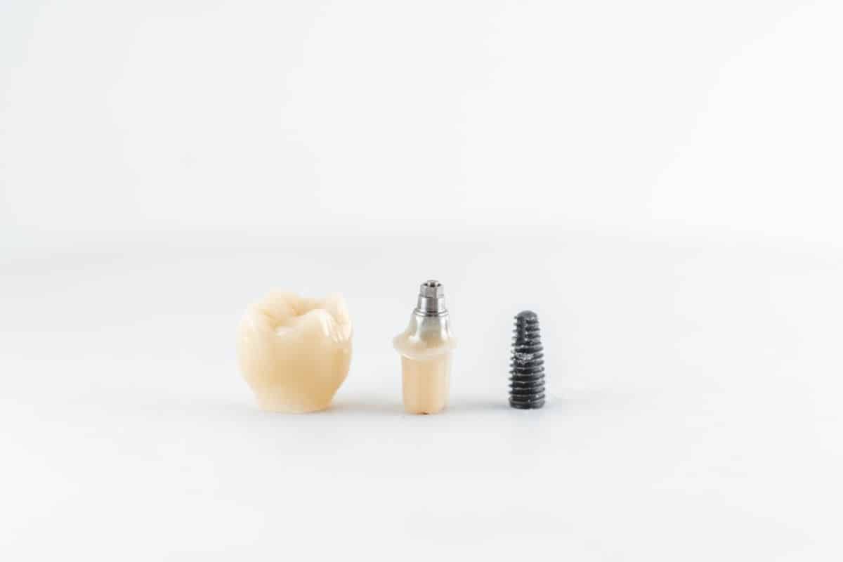 What Can I Eat After Dental Implant Surgery: Dentist-Approved Diet Tips