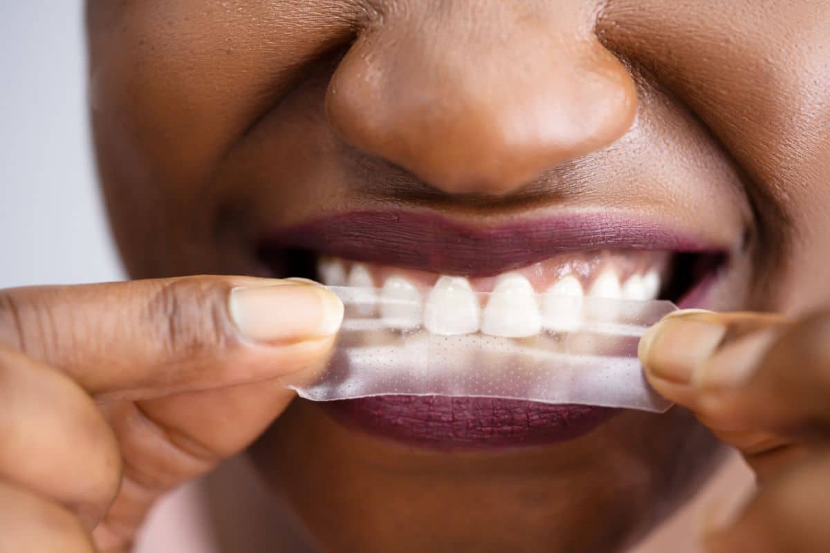 Do Teeth Whitening Strips Work for Yellow and Stained Teeth?