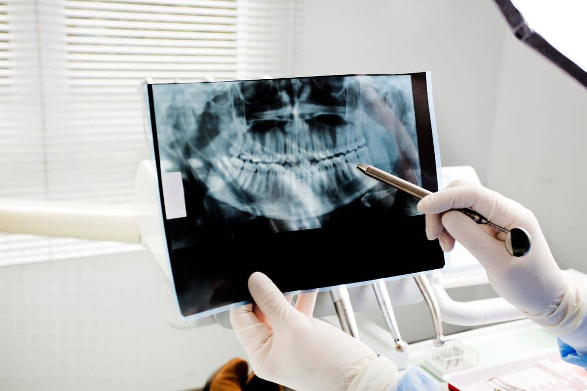 Are Dental X-Rays Safe? What Patients Need to Know