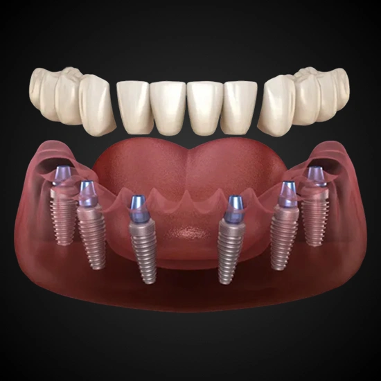 hand holding top denture