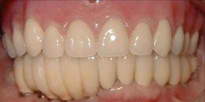 Cosmetic Dentistry Before Treatment